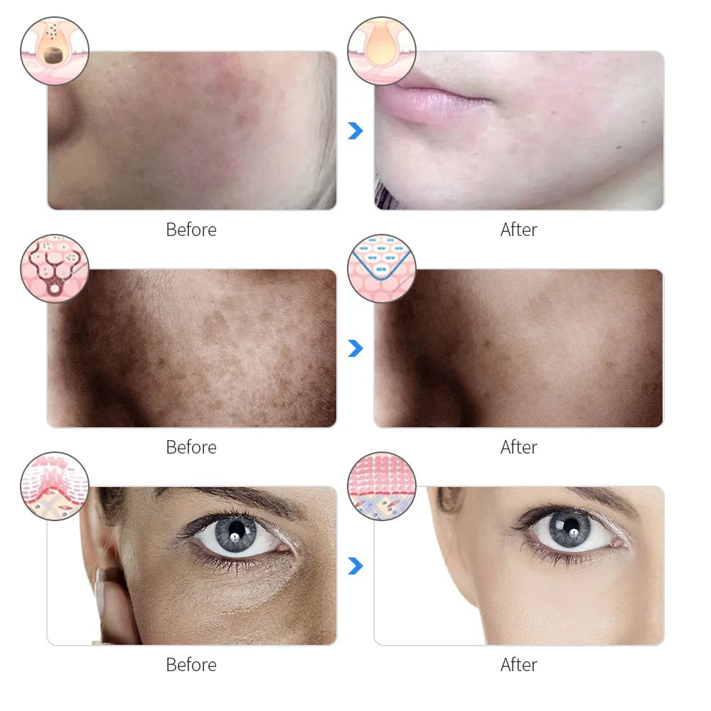 7-Color LED Face Mask – Rechargeable Anti-Aging Skin Therapy Device
