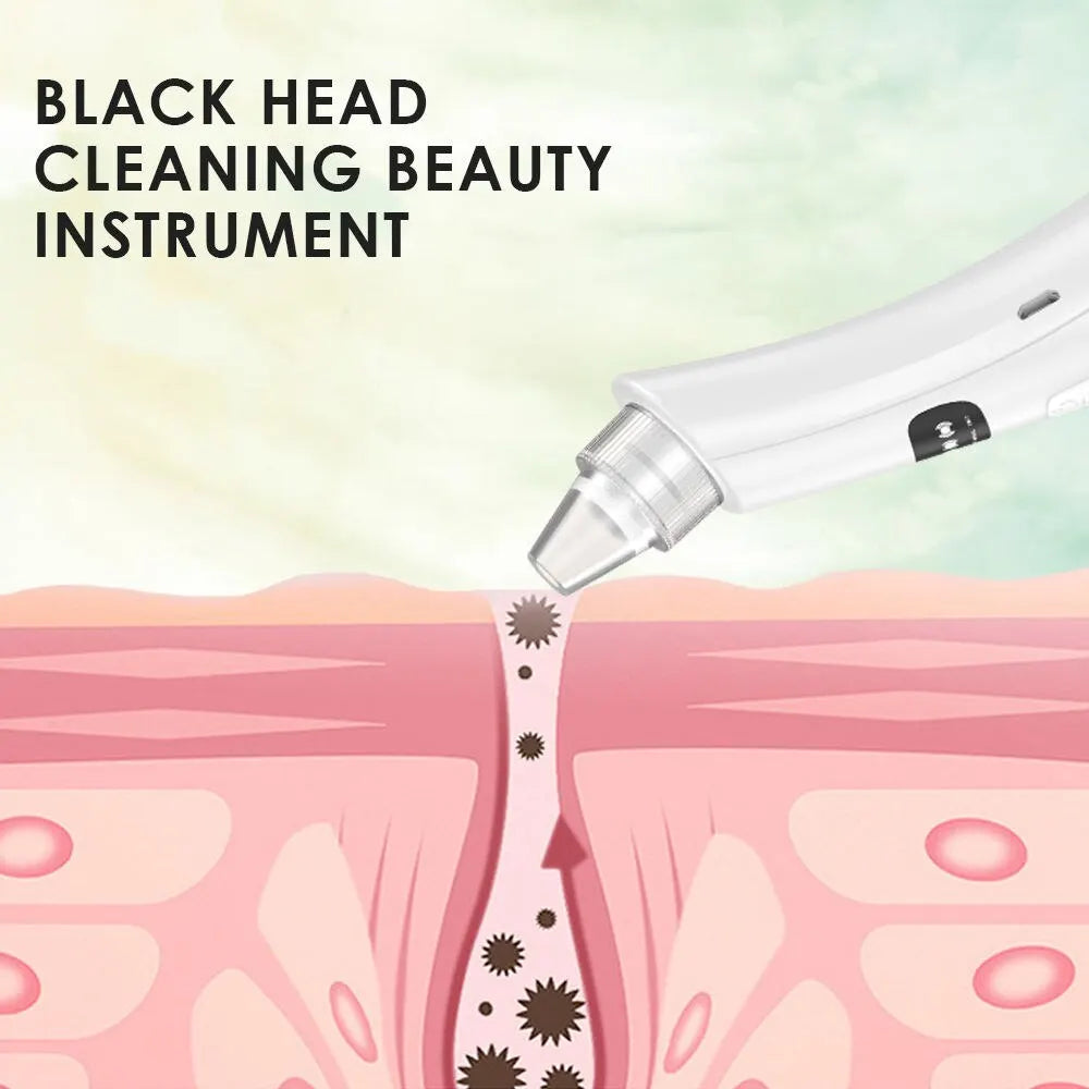PureVac™ Facial Pore Cleaner – 3-Mode Blackhead Remover