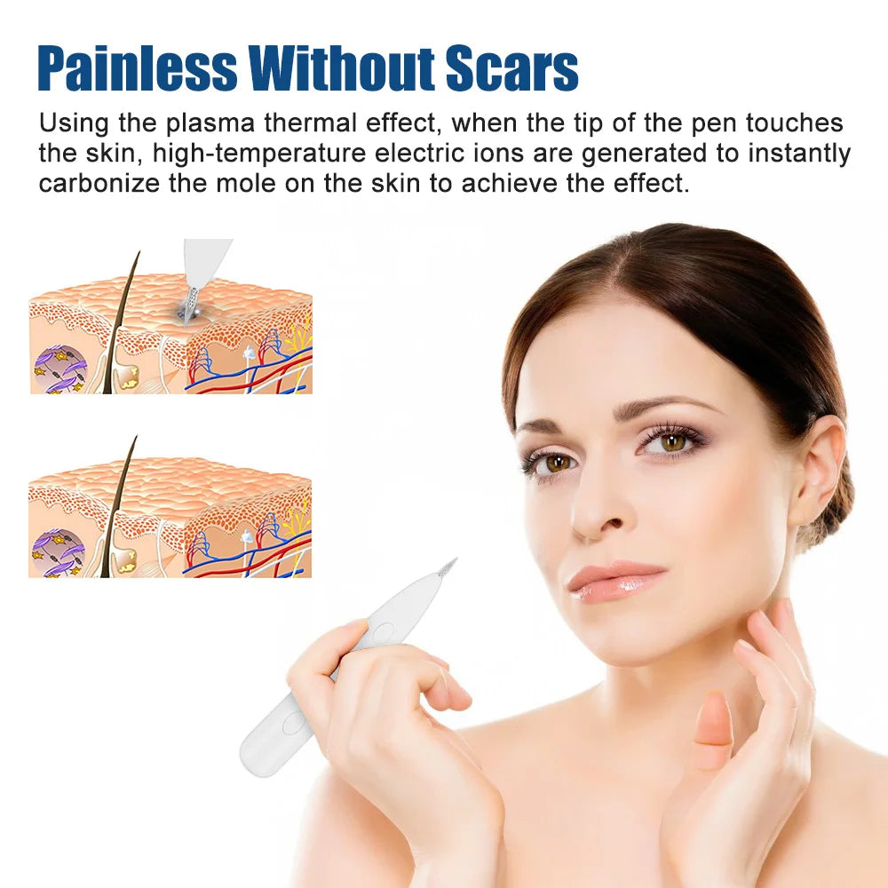 DermaLuxe Precision Spot Removal Pen