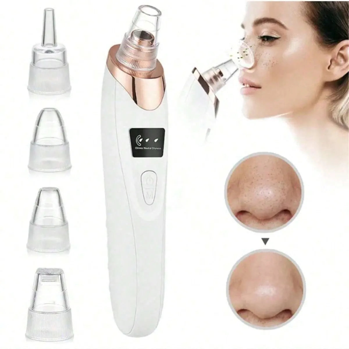 LumiClear™ Pore Vacuum – 5-Level Suction Blackhead Remover