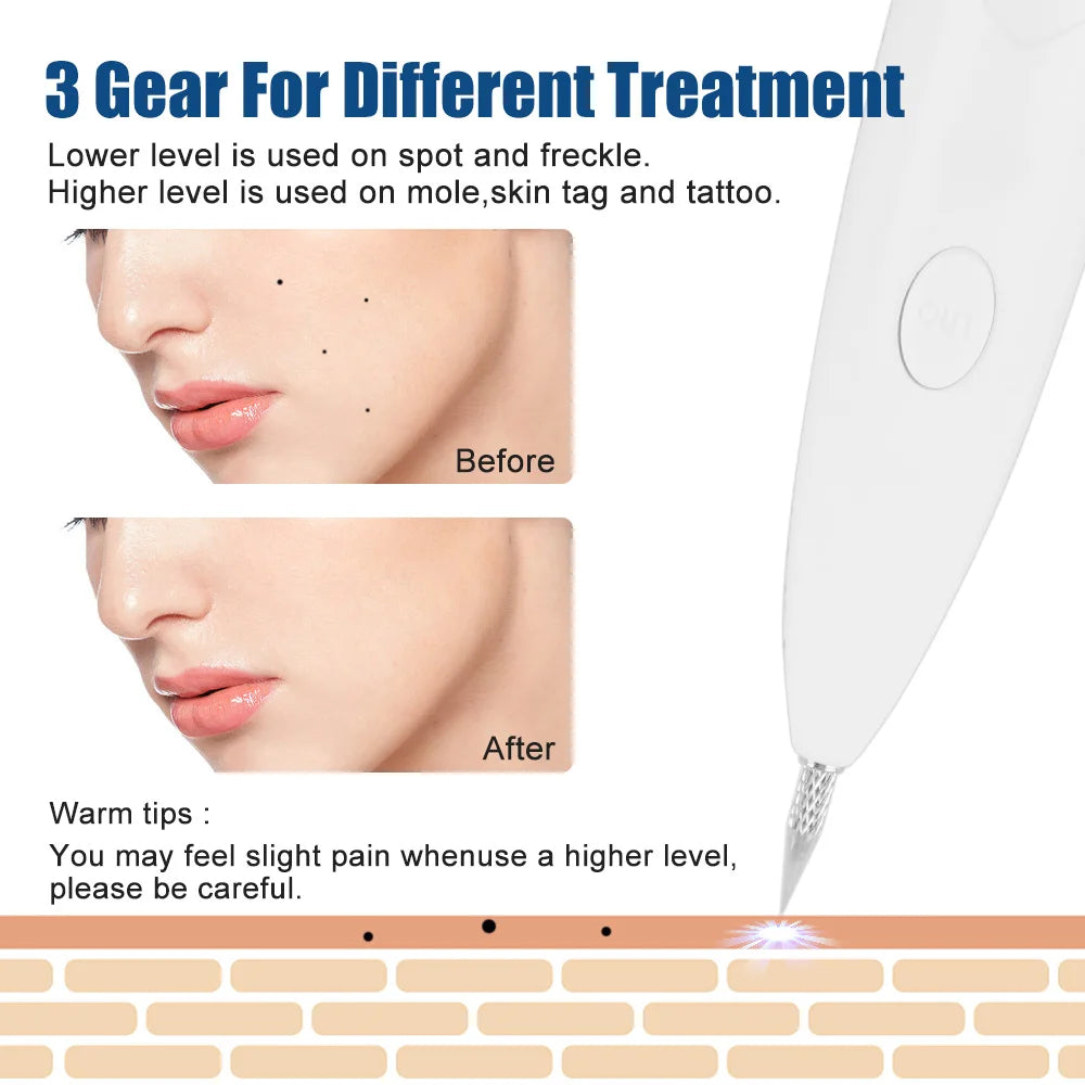DermaLuxe Precision Spot Removal Pen