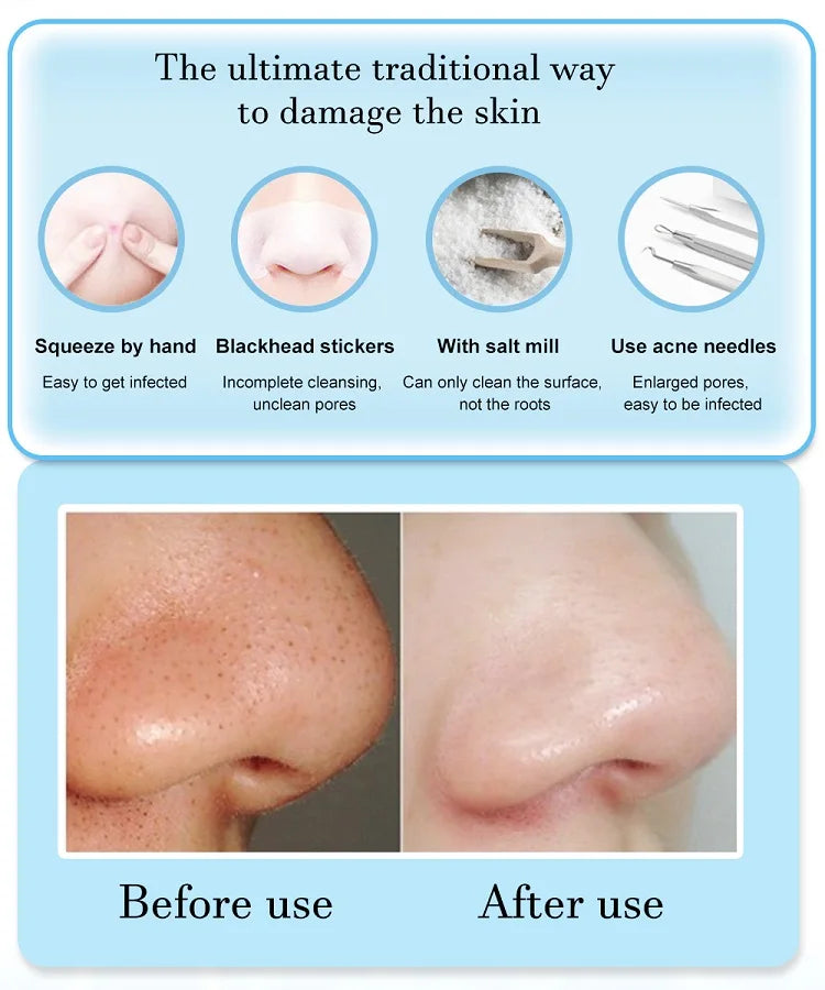 PureVac™ Facial Pore Cleaner – 3-Mode Blackhead Remover